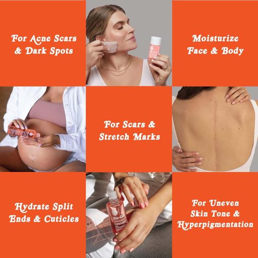 Bio Oil Skincare Oil for Scars, Stretch Marks 125ml - Image 3