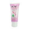 ISME Acne Oil Control Cleansing Foam With Aloe Vera & Vitamin B6 60gm